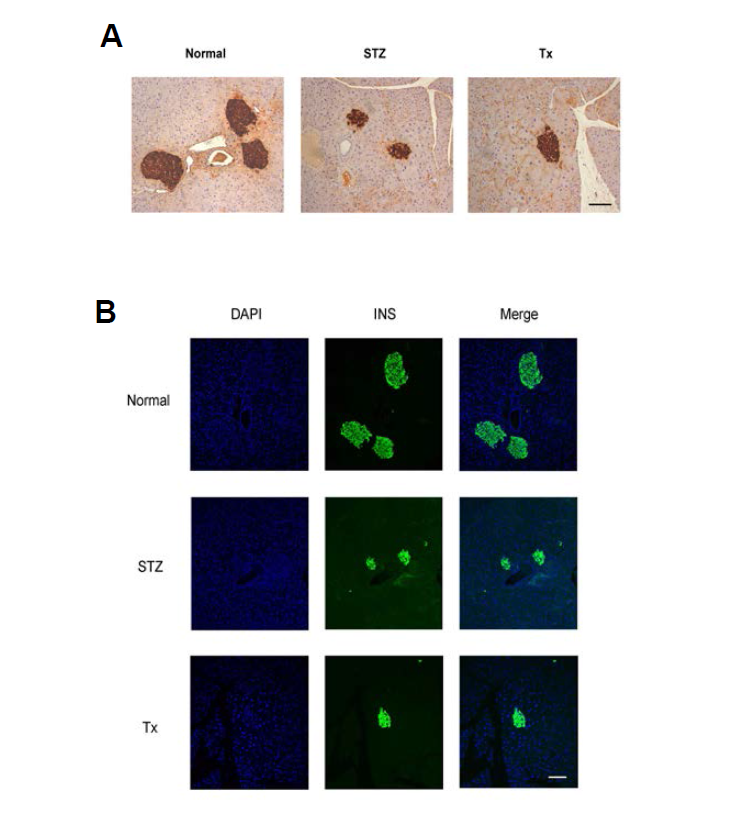 사람 지방유래 줄기세포로부터 분화 유도된 중분화 베타세포를 이식 받은 생쥐 췌장의 모습.