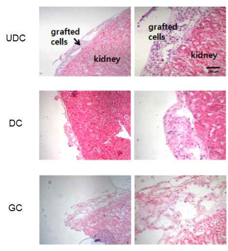 생쥐 신장 캡슐 부위로 이식된 미분화 지방유래 줄기세포와 중분화 베타세포의 hematoxylin & eosin 염색 사진.