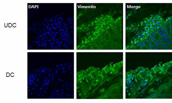 신장 켑슐 부위로 이식된 세포에서 중간엽줄기세포 마커인 vimentin 의 발현 양상.