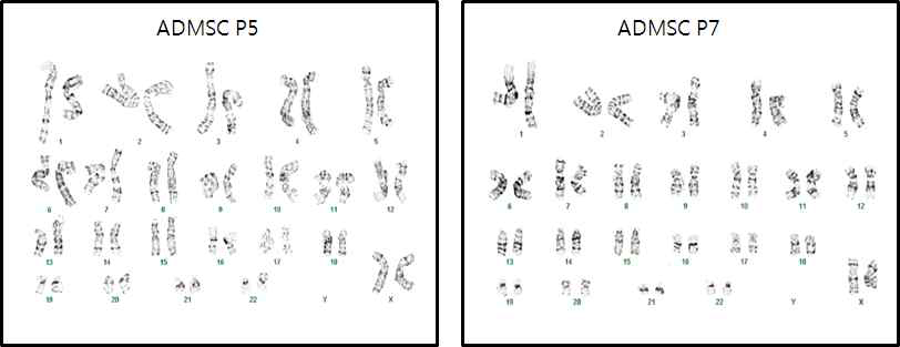 지방유래 줄기세포의 Keryotype확인