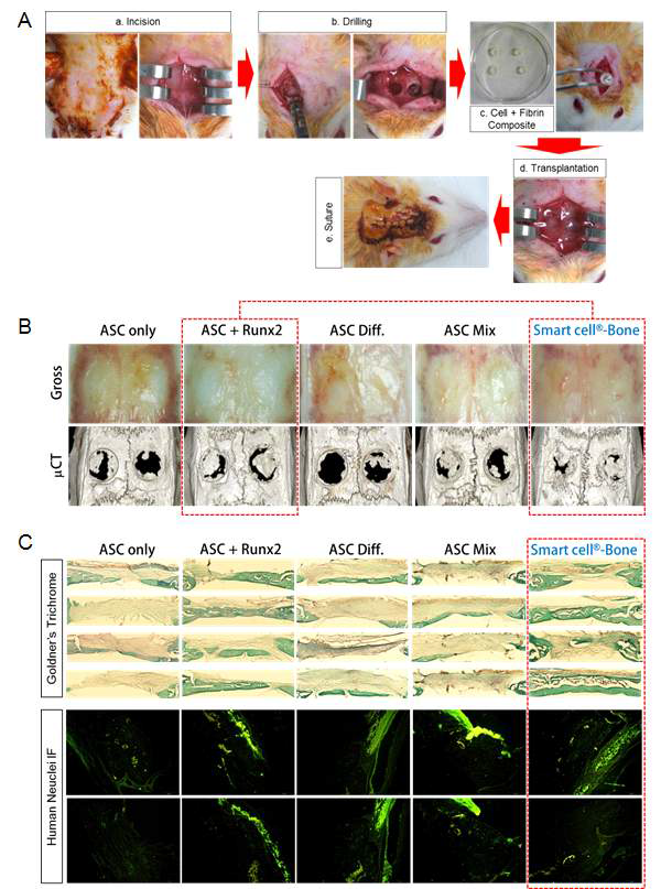 Rat calvarial defect 모델에서 최종 줄기세포 치료제 확정을 위한 골재생 유효성 연구