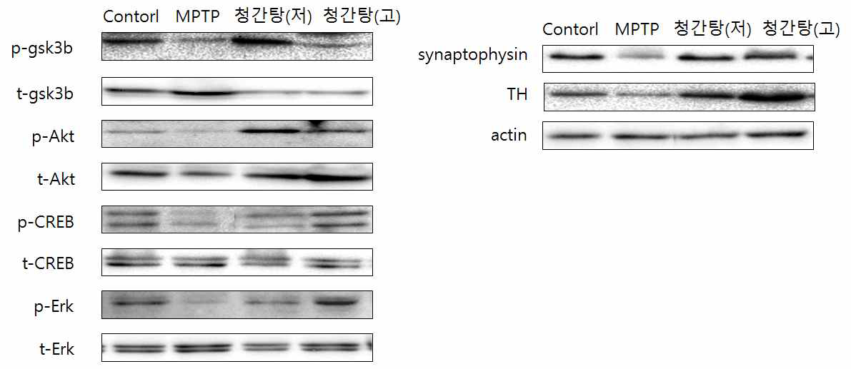 인간병태유사 파킨슨병 동물 마우스의 대뇌 피질에서 MPTP와 청간탕의 처리에 따른 단백질 발현