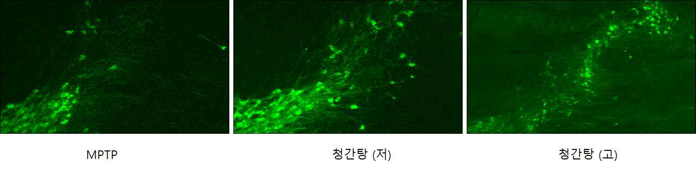 인간병태유사 파킨슨병 동물 마우스의 흑질에서 MPTP와 청간탕의 처리에 따른 TH 의 면역염색 관찰