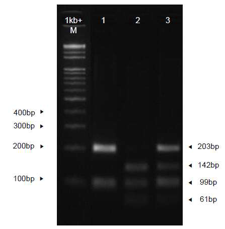 A result of PCR-RFLP analysis of the LPHN3 gene.