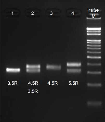 Allele distribution of DK1-uVNTR in this study