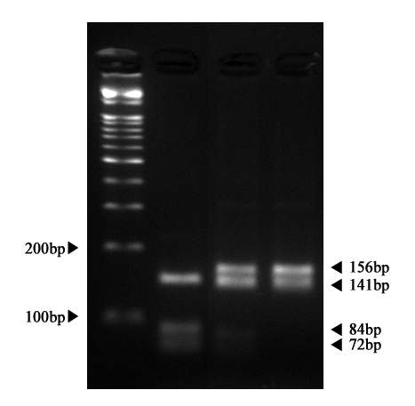 A result of PCR-RFLP analysis of the DK1 gene.