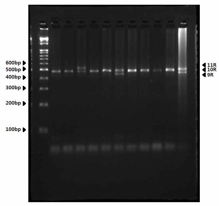 Allele distribution of DK2-VNTR in this study