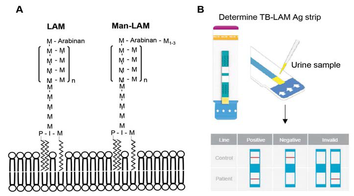 Urine lateral flow-lipoarabinomannan (LF-LAM) 분석법.