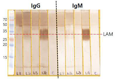 LAM항원을 SDS-PAGE로 분리하고 항원을 면역한 마우스 혈청으로 반응 패턴을 분석함. 혈청은 100배 희석하여 4˚c에서 overnight반응시킴. 이차항체는 각각 2,000배 희석하여 반응시킴