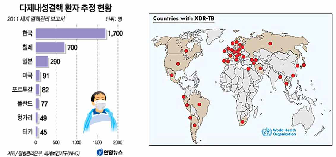 여러 종류의 치료제에 내성을 지닌 다약제내성결핵(MDR-TB)이 전 세계적 위협으로 떠오른 가운데 우리나라의 M/XDR-TB 환자 수가 경제협력개발기구(OECD) 국가 중 가장 많다는 추정치가 처음 나왔음