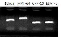 증폭된 유전자의 전기영동 확인결과