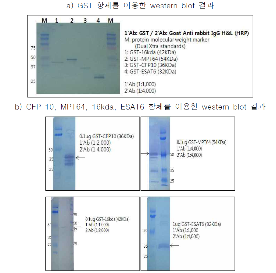 결핵 항원과 결핵 항체 반응에 대한 western blot 결과