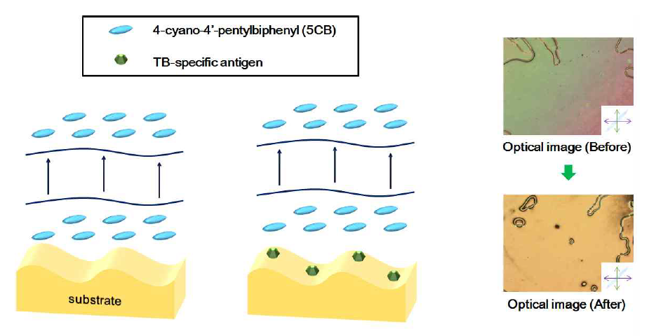 결핵특이 항원 고정에 따른 액정 배열 변화
