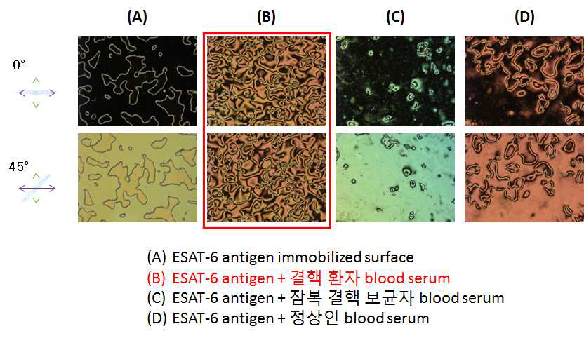 항원(ESAT-6) - Blood serum 반응 단계별 액정 이미지