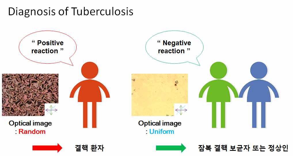 임상에서 증명된 결핵환자와 비 결핵환자에 대한 검지기술 확립