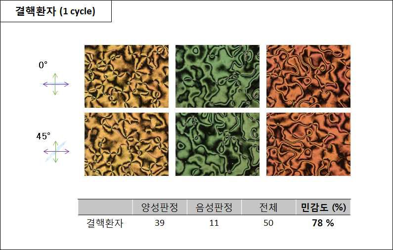 임상에서 증명된 활동성 결핵 환자 샘플의 민감도 검사 - ①