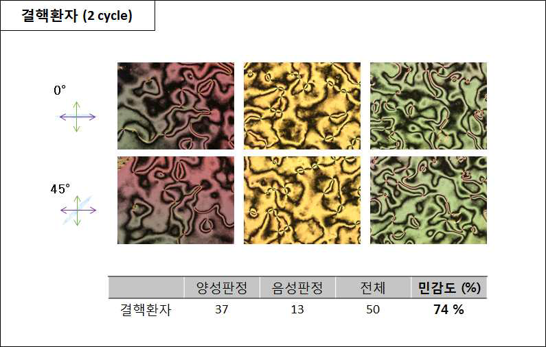 임상에서 증명된 활동성 결핵 환자 샘플의 민감도 검사 - ②