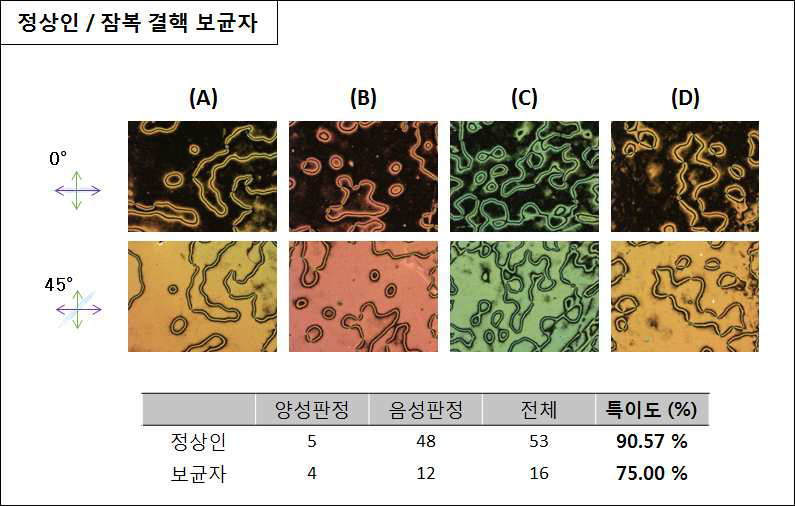 임상에서 증명된 정상인 샘플과 잠복 결핵 보균자 샘플의 특이도 검사