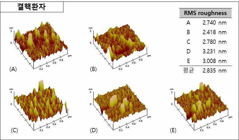 표면 고정된 항원과 결핵환자 혈청의 반응에 따른 AFM 이미지 및 RMS rougness