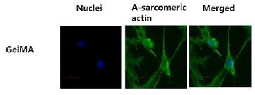 세포지지체에서의 α-sacromeric actin 발현 확인