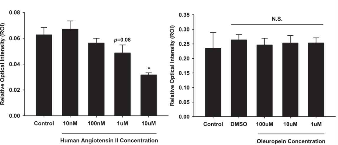 Angiotensin II처리를 통한 심혈관 병태생리학적 세포모델의 확립