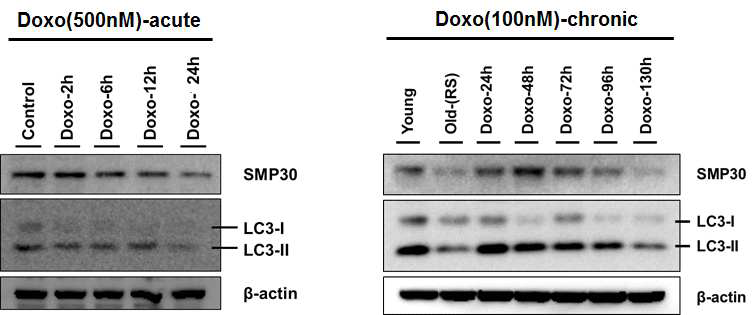 Doxorubicin 처리를 통한 심장전구세포의 병태생리학적 모델 확립