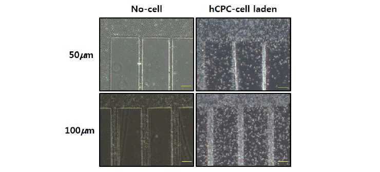 세포캡슐화 및 photolithography를 통한 심근줄기세포시트의 패턴화