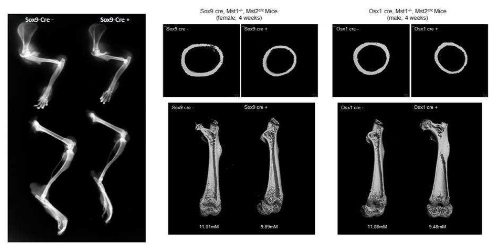 conditional Mst1/2 유전자 녹아웃 생쥐의 뼈의 x-Ray 및 MicroCT 사진 (4주)