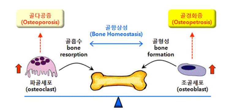 뼈의 항상성 유지와 대표적인 뼈 질환