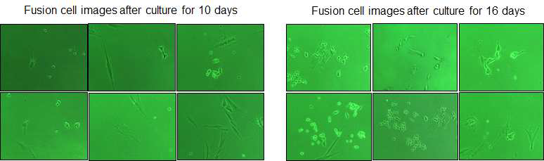 지방유래 중간엽줄기세포와 사멸중인 운동신경세포의 융합 후 배양 10일 및 16일 째의 융합세포의 현미경학적 분석.