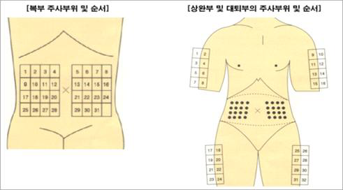 인슐린 주사 가능한 부위