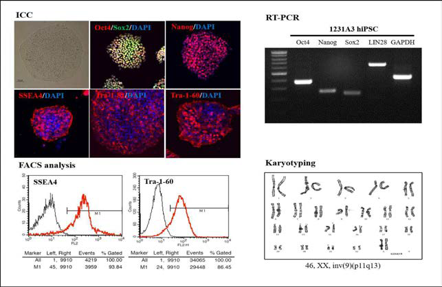 유도만능줄기세포주의 미분화특성분석