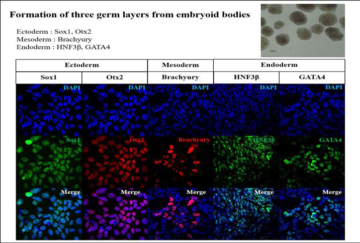 제작된 유도만능줄기세포주 (CMC-hiPSC-001)의 삼배엽분화능 확인