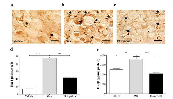 PLA2 전처치의 옥살리플라틴에 의한 대식세포 DRG 침윤 및 IL-1β 억제