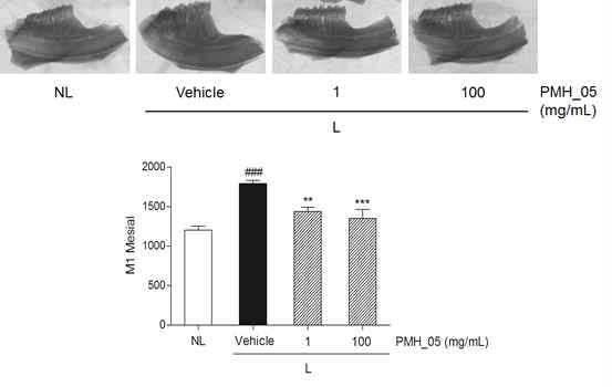 Effect of topical PMH-05 treatment on M1-Mesial