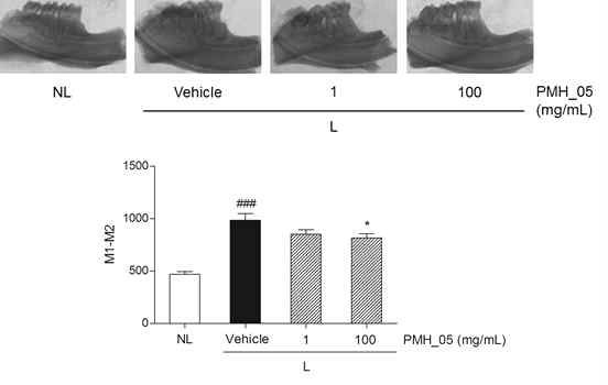 Effect of topical PMH-05 treatment on M1-M2.