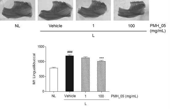 Effect of PMH-05 treatment on M1 Lingual&buccal