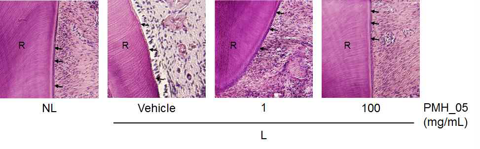 Histopathological observations in cementum