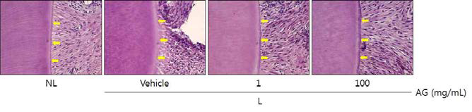 Histopathological observations in cementum