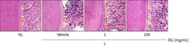 Histopathological observations in cementum