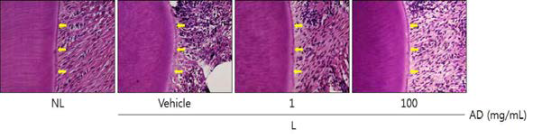 Histopathological observations in cementum