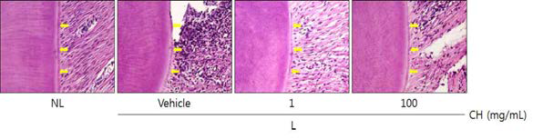 Histopathological observations in cementum