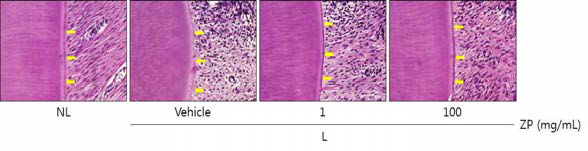 Histopathological observations in cementum