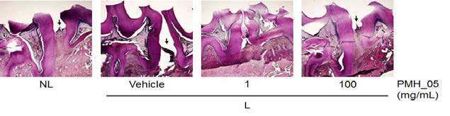 Histopathological observations in gingival tissue