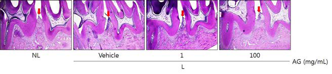 Histopathological observations in gingival tissue