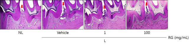 Histopathological observations in gingival tissue