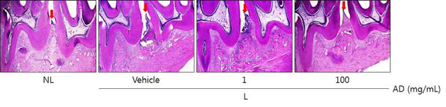 Histopathological observations in gingival tissue