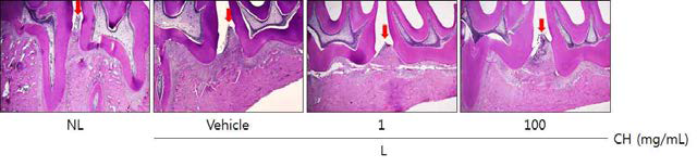 Histopathological observations in gingival tissue