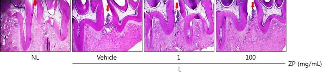 Histopathological observations in gingival tissue