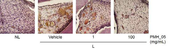 Histological photographs of TRAP-stained sections